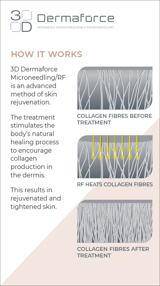 MAR-DMF-HOWWK-INSTAST-REV01_dmf-stories-how-it-works
